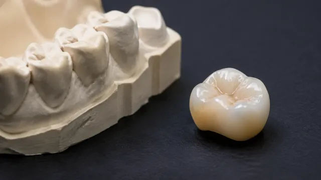 Natural-looking all-ceramic crown beside a dental model